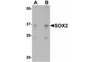 Image no. 1 for anti-SRY (Sex Determining Region Y)-Box 2 (SOX2) (N-Term) antibody (ABIN478109) (SOX2 antibody  (N-Term))