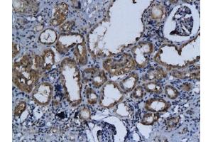 Formalin-fixed and paraffin embedded rat kidney labeled with Anti-Talin Polyclonal Antibody, Unconjugated (ABIN701695) followed by conjugation to the secondary antibody and DAB staining (TLN1 antibody  (AA 1601-1750))