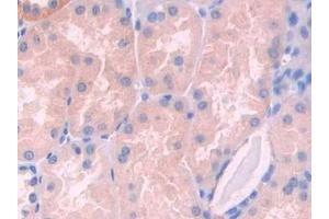 Detection of LCAT in Human Kidney Tissue using Polyclonal Antibody to Lecithin Cholesterol Acyltransferase (LCAT) (LCAT antibody  (AA 290-433))