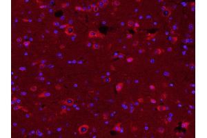 Paraformaldehyde-fixed, paraffin embedded Mouse brain; Antigen retrieval by boiling in sodium citrate buffer (pH6. (TUBB3 antibody  (AA 401-450) (Alexa Fluor 594))