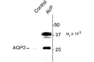 Western blot of vasopressin (AVP) treated Rat kidney lysate showing specific immunolabeling of the ~ 29k and 37k glycosylated form of the AQP2 protein phosphorylated at Ser264. (AQP2 antibody  (pSer264))
