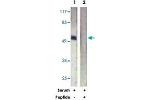 Western blot analysis of extracts from HeLa cells, treated with Serum (20 %, 15 mins), using ETS1 polyclonal antibody . (ETS1 antibody)
