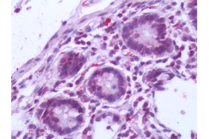 Human Small Intestine: Formalin-Fixed, Paraffin-Embedded (FFPE) (NR5A2 + LRH1 antibody  (Internal Region))