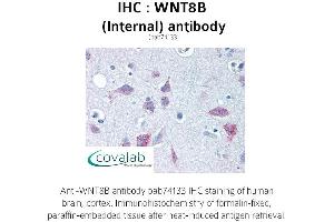Image no. 2 for anti-Wingless-Type MMTV Integration Site Family, Member 8B (WNT8B) (Internal Region) antibody (ABIN1740842) (WNT8B antibody  (Internal Region))
