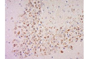 Paraformaldehyde-fixed, paraffin embedded mouse brain, Antigen retrieval by boiling in sodium citrate buffer (pH6) for 15min, Block endogenous peroxidase by 3% hydrogen peroxide for 30 minutes, Blocking buffer (normal goat serum) at 37°C for 20min, Antibody incubation with Rabbit Anti-MSK1 (Ser360) Polyclonal Antibody, Unconjugated  at 1:500 overnight at 4°C, followed by a conjugated secondary for 90 minutes and DAB staining. (MSK1 antibody  (pSer360))
