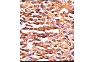 Image no. 2 for anti-Protein Phosphatase 2, Catalytic Subunit, alpha Isozyme (PPP2CA) (AA 1-30), (N-Term) antibody (ABIN360806) (PPP2CA antibody  (N-Term))