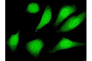 Immunofluorescence (IF) image for anti-Sirtuin 2 (SIRT2) (AA 128-227) antibody (ABIN564966)