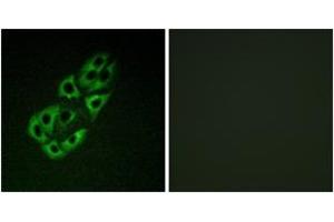 Immunofluorescence analysis of A549 cells, using MtSSB Antibody. (SSBP1 antibody  (AA 99-148))