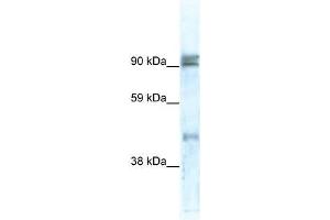 Western Blot showing ZNF227 antibody used at a concentration of 1-2 ug/ml to detect its target protein. (ZNF227 antibody  (N-Term))