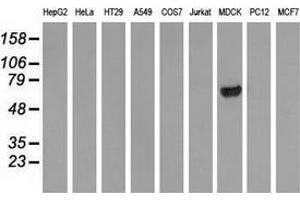 Western blot analysis of extracts (35 µg) from 9 different cell lines by using anti-ARHGAP25 monoclonal antibody. (ARHGAP25 antibody)