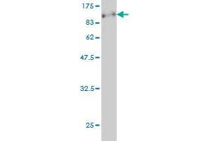 Western Blot detection against Immunogen (89. (CDKN2AIP antibody  (AA 1-579))