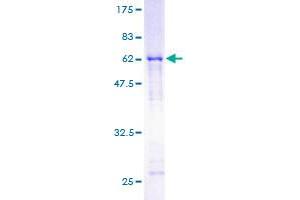 SET/TAF-I Protein (AA 1-277) (GST tag)