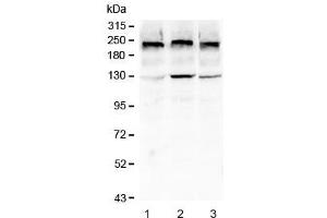 Western blot testing of human 1) HEK293T, 2) HeLa and 3) A549 cell lysate with Collagen IV antibody at 0. (Collagen IV antibody  (AA 1445-1669))