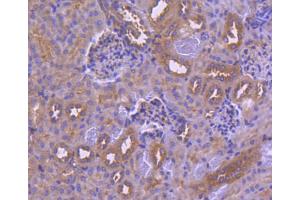 Paraformaldehyde-fixed, paraffin embedded human kidney tissue, Antigen retrieval by boiling in sodium citrate buffer (pH6) for 15min, Block endogenous peroxidase by 3% hydrogen peroxide for 30 minutes, Blocking buffer (normal serum) at 37°C for 20min, Antibody incubation with IRF6 (1A1) Monoclonal Antibody  at 1:50 overnight at 4°C, followed by a conjugated secondary and DAB staining. (IRF6 antibody)