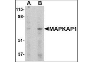 Western blot analysis of MAPKAP1 in human skeletal muscle tissue lysate with this product at (A) 1 and (B) 2 μg/ml. (Transportin 1 antibody  (Center))