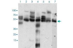 Western blot analysis of Lane 1: Hela cell lysate; Lane 2: K562 cell lysate; Lane 3: NIH/3T3 cell lysate; Lane 4: C6 cell lysate; Lane 5: MCF-7 cell lysate; Lane 6: Jurkat cell lysate; Lane 7: A431 cell lysate with CCNE1 monoclonal antibody, clone 5F8C5  at 1:500-1:2000 dilution. (Cyclin E1 antibody  (AA 307-410))
