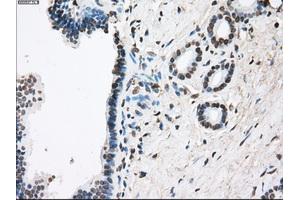 Immunohistochemical staining of paraffin-embedded Ovary tissue using anti-FCGR2A mouse monoclonal antibody. (FCGR2A antibody)