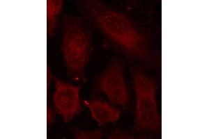 Immunofluorescence staining of methanol-fixed HeLa cells using Phospho-DOK2-Y299 antibody (ABIN2987731). (DOK2 antibody  (pTyr299))