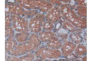 Figure. (Maltase-Glucoamylase (MGAM) (AA 213-392) antibody)