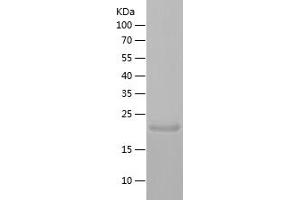 Reticulon 1 Protein (RTN1) (AA 1-172) (His tag)