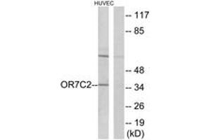 Western blot analysis of extracts from HuvEc cells, using OR7C2 Antibody. (OR7C2 antibody  (AA 198-247))