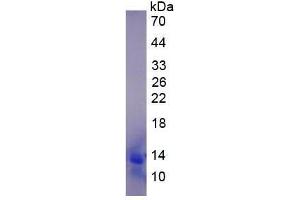 Image no. 2 for Chemokine (C-C Motif) Ligand 13 (CCL13) (AA 17-98) protein (His tag) (ABIN1880091) (CCL13 Protein (AA 17-98) (His tag))