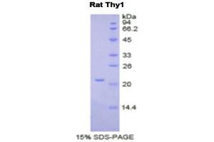 SDS-PAGE (SDS) image for CD90 (THY1) (AA 1-161) protein (His tag) (ABIN2122204)