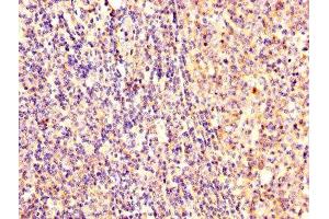 IHC image of ABIN7152369 diluted at 1:300 and staining in paraffin-embedded human tonsil tissue performed on a Leica BondTM system. (Ezrin antibody  (AA 1-251))