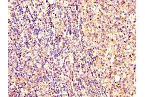 IHC image of ABIN7152369 diluted at 1:300 and staining in paraffin-embedded human tonsil tissue performed on a Leica BondTM system. (Ezrin antibody  (AA 1-251))