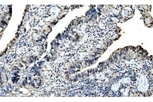 IHC analysis of DLX2 using anti-DLX2 antibody (ABIN7599936). (DLX2 antibody  (AA 13-310))