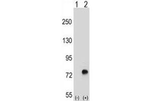 Western blot analysis of TGFBI antibody and 293 cell lysate either nontransfected (Lane 1) or transiently transfected (2) with the TGFBI gene. (TGFBI antibody  (AA 106-135))