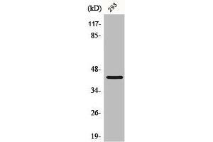 Western Blot analysis of HepG2 cells using CBX6 Polyclonal Antibody