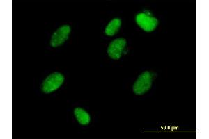 Immunofluorescence of  purified  MaxPab antibody to ZFP1 on HeLa cell. (Zfp-1 antibody  (AA 1-352))
