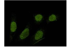 SUN1 antibody