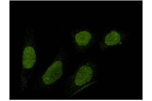 SUN1 antibody