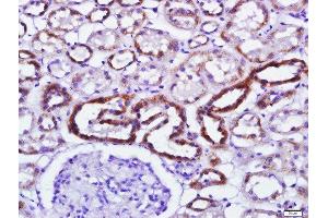 Paraformaldehyde-fixed, paraffin embedded human kidney tissue, Antigen retrieval by boiling in sodium citrate buffer(pH6) for 15min, Block endogenous peroxidase by 3% hydrogen peroxide for 30 minutes, Blocking buffer (normal goat serum) at 37°C for 20min, Antibody incubation with Rabbit Anti-PKR(Thr446+Thr451) Polyclonal Antibody, Unconjugated  at 1:500 overnight at 4°C, followed by a conjugated secondary and DAB staining (EIF2AK2 antibody  (pThr446, pThr451))