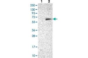 Western blot analysis of Lane 1: Negative control (vector only transfected HEK293T lysate), Lane 2: Over-expression Lysate (Co-expressed with a C-terminal myc-DDK tag (~3. (TC2N antibody)