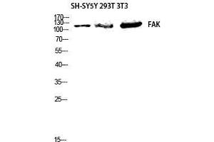 Western Blot (WB) analysis of SH-SYSY 293 3T3 lysis using FAK antibody. (FAK antibody  (Thr444))