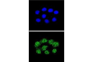 Confocal immunofluorescent analysis of MSH2 Antibody (Center) (ABIN655517 and ABIN2845032) with Hela cell followed by Alexa Fluor® 488-conjugated goat anti-rabbit lgG (green). (MSH2 antibody  (AA 637-665))