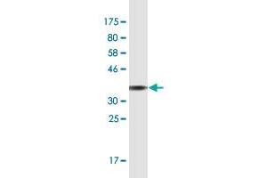 Western Blot detection against Immunogen (36. (TLN1 antibody  (AA 1324-1424))