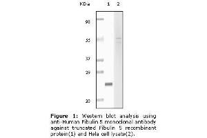 Image no. 1 for anti-Fibulin 5 (FBLN5) antibody (ABIN232103) (Fibulin 5 antibody)