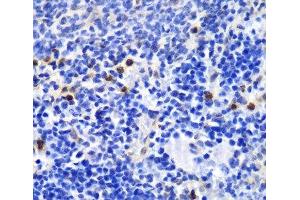 Immunohistochemistry of paraffin-embedded Mouse spleen using ANXA1 Polyclonal Antibody at dilution of 1:100 (40x lens). (Annexin a1 antibody)