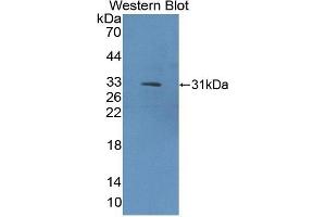 Detection of Recombinant COL9a1, Rat using Polyclonal Antibody to Collagen Type IX Alpha 1 (COL9a1) (COL9A1 antibody  (AA 24-268))