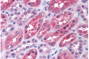 Human Kidney: Formalin-Fixed, Paraffin-Embedded (FFPE) (LMTK2 antibody  (AA 1181-1280))