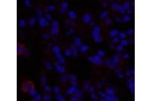 Immunofluorescence analysis of Rat lung tissue using TGFB1 Polyclonal Antibody at dilution of 1:200. (TGFB1 antibody)