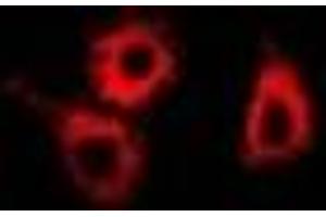 Immunofluorescent analysis of SMYD4 staining in MCF7 cells. (SMYD4 antibody)
