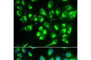Immunofluorescence analysis of MCF-7 cells using SLC22A5 Polyclonal Antibody (SLC22A5 antibody)