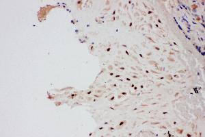 Immunohistochemistry (IHC) image for anti-Protein Inhibitor of Activated STAT, 1 (PIAS1) (AA 636-651), (C-Term) antibody (ABIN3044474)