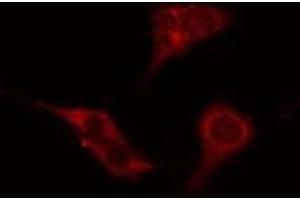 ABIN6276528 staining Hela cells by IF/ICC. (ATG4C antibody  (N-Term))
