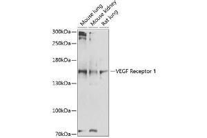 Western blot analysis of VEGFR1 expression using ABIN6140687 (FLT1 antibody  (AA 20-300))